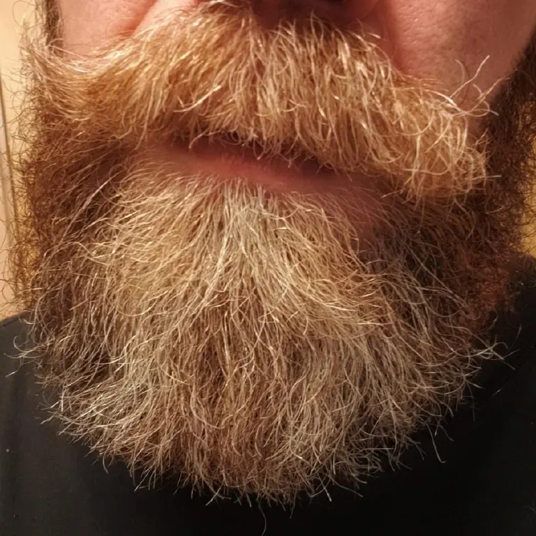 Beard / mustache selfie, with one side of mustache relatively tidy and the other completely haywire